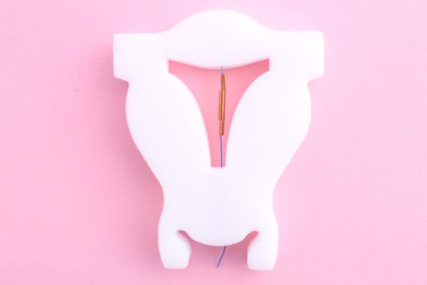 Son Yılların Gözdesi: Yeni Nesil Rahim İçi Araç (RİA) ” GYNEFİX- GYNEFİX CS”